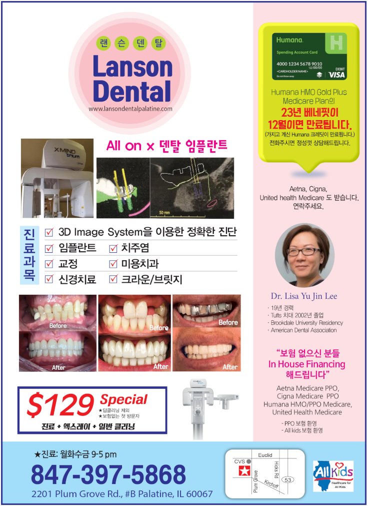 [랜슨 덴탈] Lanson Dental  All on x 덴탈 임플란트