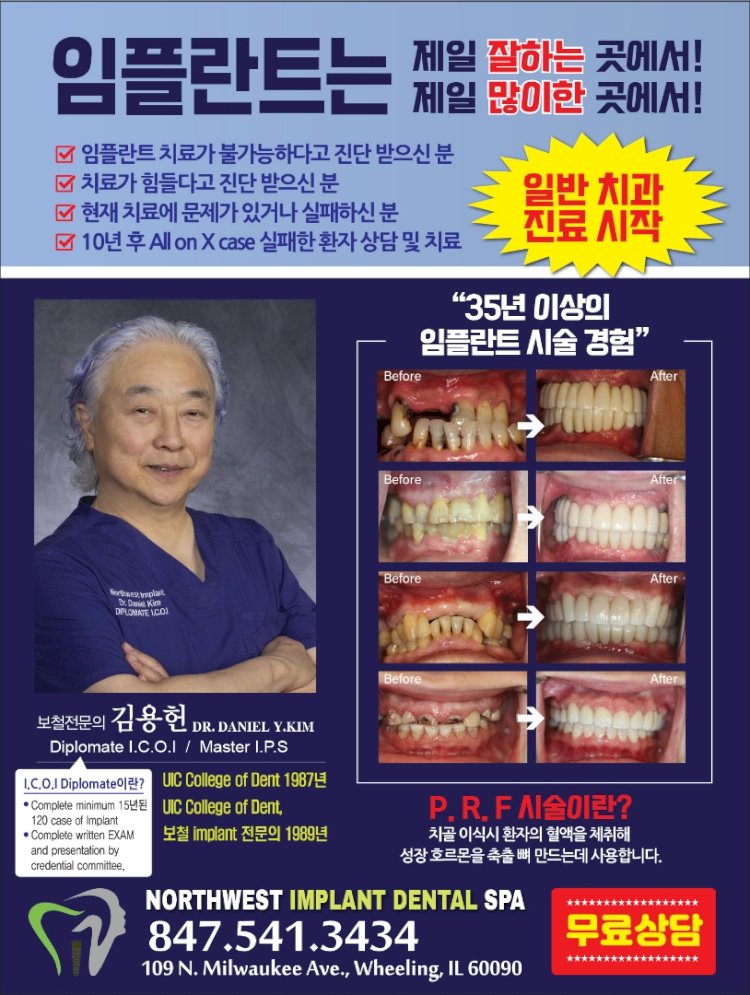 [NOTHWEST IMPLANT DENTAL SPA] 보철전문의 김용헌 -임플란트 제일 잘하는 곳에서!!  임플란트 제일 많이한 곳에서!! 일반 치과 진료 시작